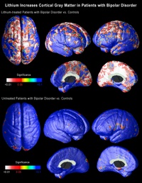brain groth